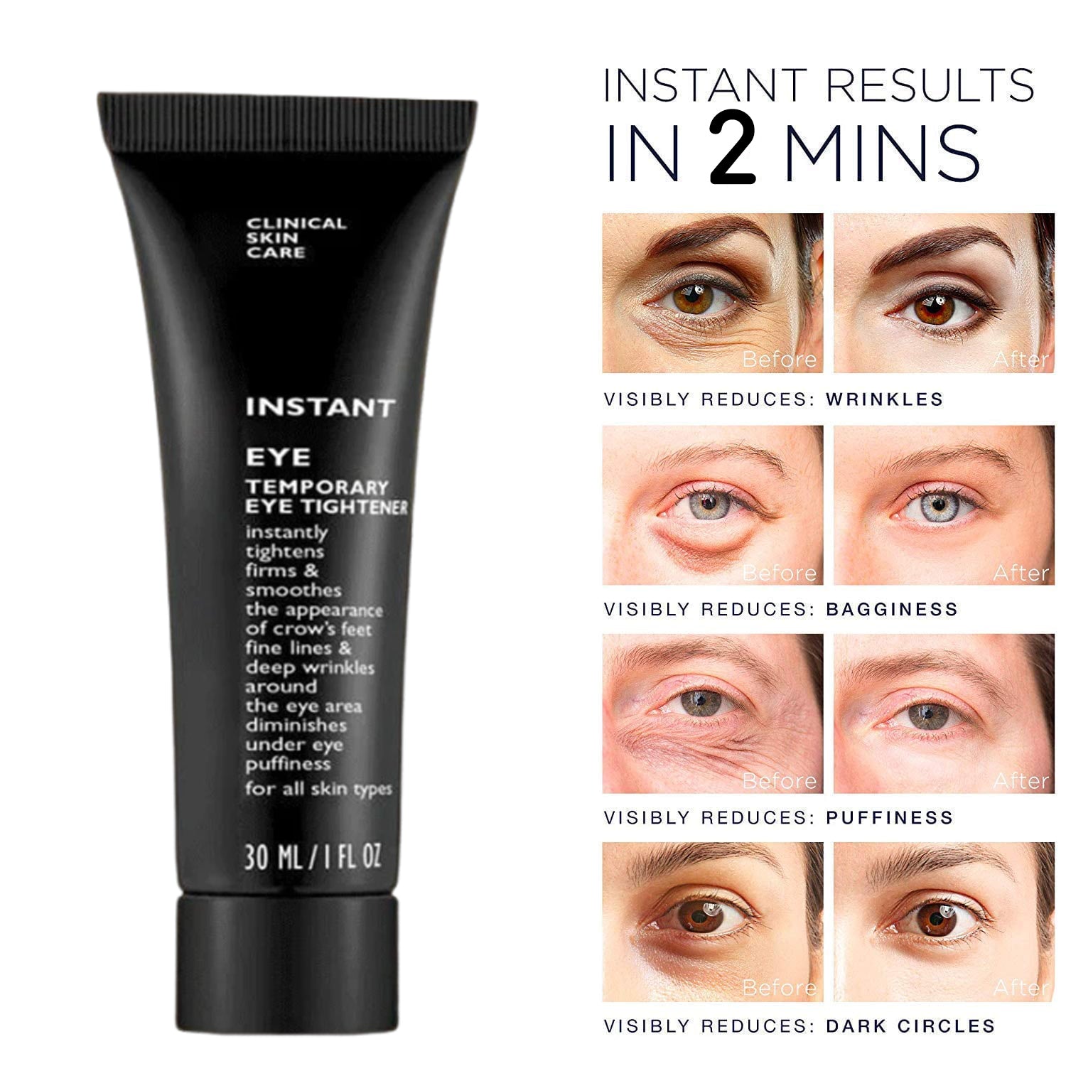 Instant Wrinkle Eye Tightener Cream